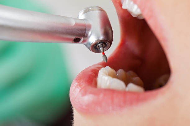 Best Emergency Treatment for Dental Infections or Abscesses in Momence, IL